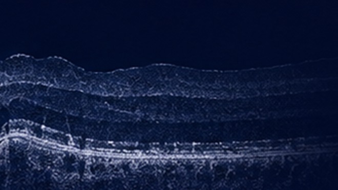Optical coherence tomography cross-sectional scan showing the layered structure of skin.